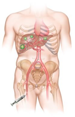 Body diagram